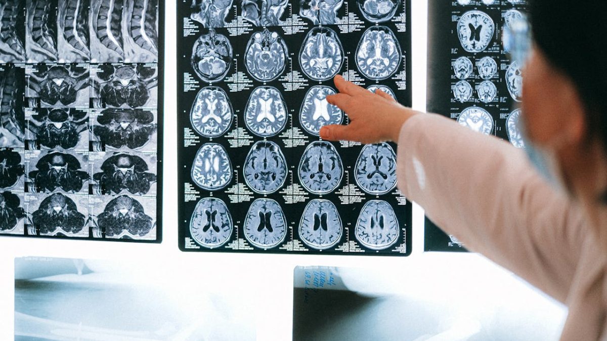 Canada and Global Partners Invest $44.8 Million to Advance Brain Health and Dementia Research